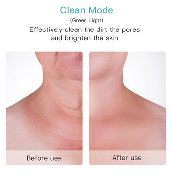 Face Beauty 3 цветен LED фотонна терапия Skin Tighten Reduce Double Chin Anti Wrinkle Remove Neck Lifting Massager Инструменти за грижа за кожата