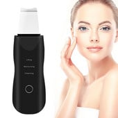 Ultrahangos bőrradír mélytisztító arcradír vibráló arctisztítás egészséges bőr spatula peeling szépségápolási eszköz