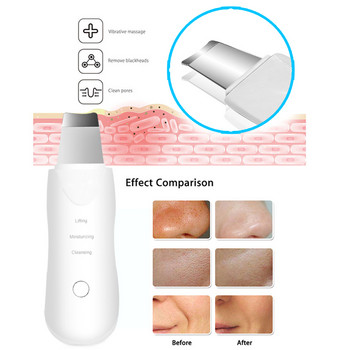 Ultrasonic Skin Scrubber Deep Cleaning Face Scrubber Vibrating Face Cleaning Healthy Skin Spatula Peeling Beauty Instrument