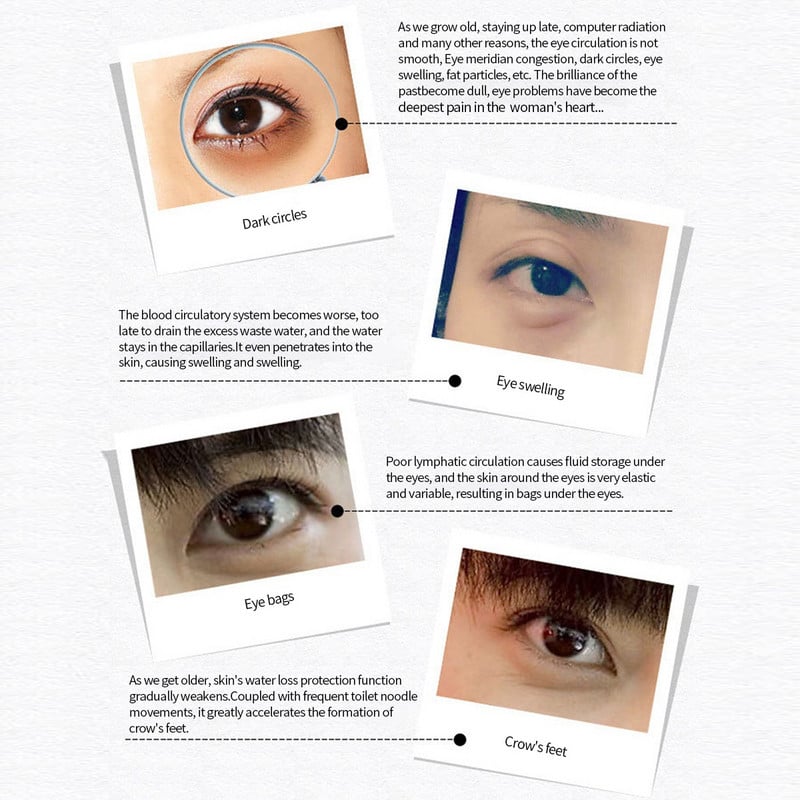 Eye Beauty Instrument Vibration Eye Massage Instrument Eye Cream Import Instrument Eye Beauty Eye Beauty Instruments