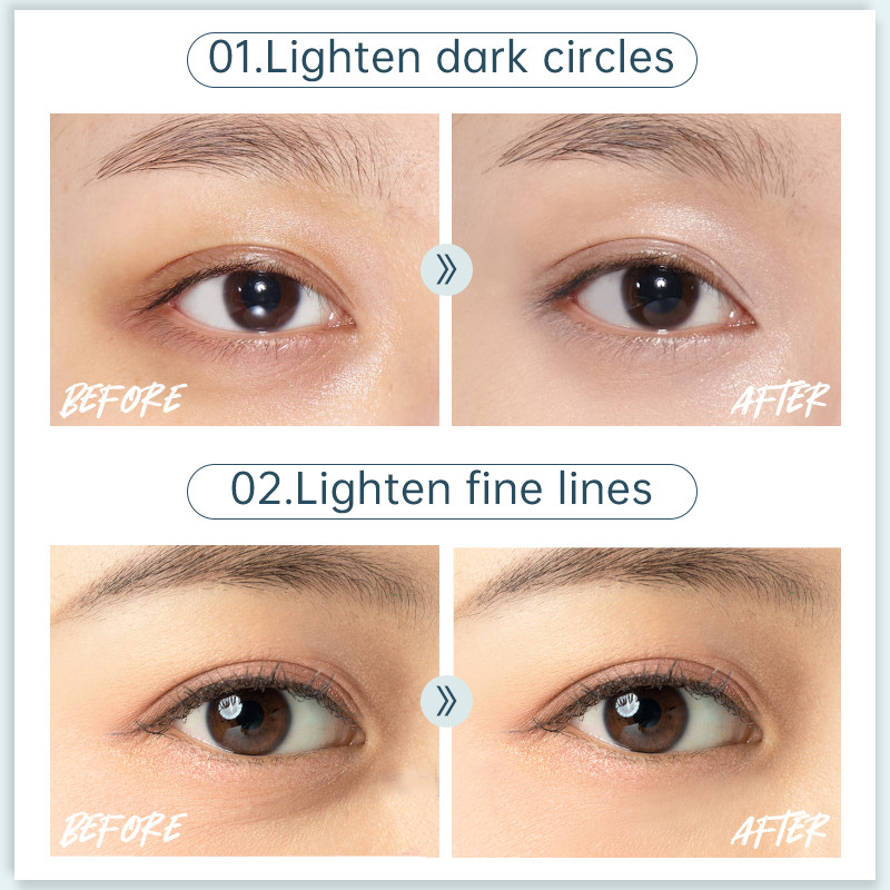 Električni masažer za oči Vibracija Grijani uređaji za uljepšavanje očiju Olovka za njegu očiju Plavo Crveno svjetlo Podočnjaci Uklanjanje natečenosti Bore