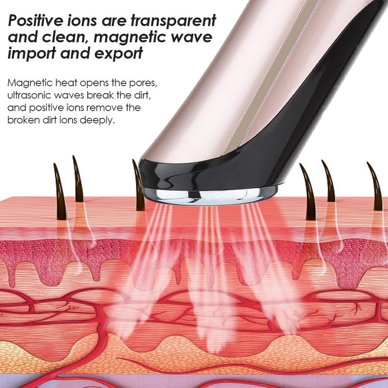 EMS Arcmasszírozó Vibrációs Forró tömörítés Ránctalanítás Skin Frim Tightening Lifting kezelés Bőrápoló Beauty Device