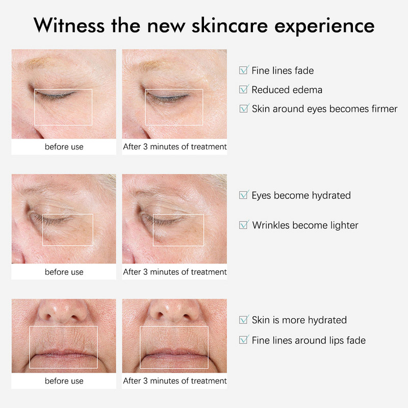 Мини високочестотен масаж на очите Релаксация Лифтинг/Стягане Премахване на бръчки Тъмни кръгове Подмладяване Устройство за красота на очите Писалка за красота