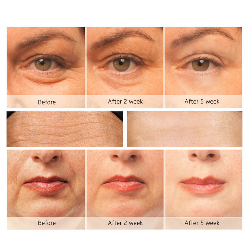 Električni uređaj za uljepšavanje očiju Eye Anti-Ageing masažni štapić Uljepšavajući uređaj za uklanjanje tamnih krugova ispod očiju Ženska olovka za njegu