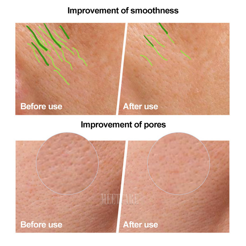 4 spalvų LED veido kaukė silikoninė gelis SPA raudonos šviesos terapija veidui kaklui Photon NIR šviesos odos atjauninimas nuo raukšlių spuogų