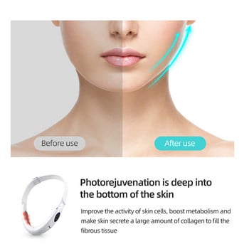 Ζώνη διαμόρφωσης προσώπου CkeyiN Microcurrent V EMS Face Slimming Massager Double Chin Remover Face Lifting LED Photon Jaw Cheek Slimmer