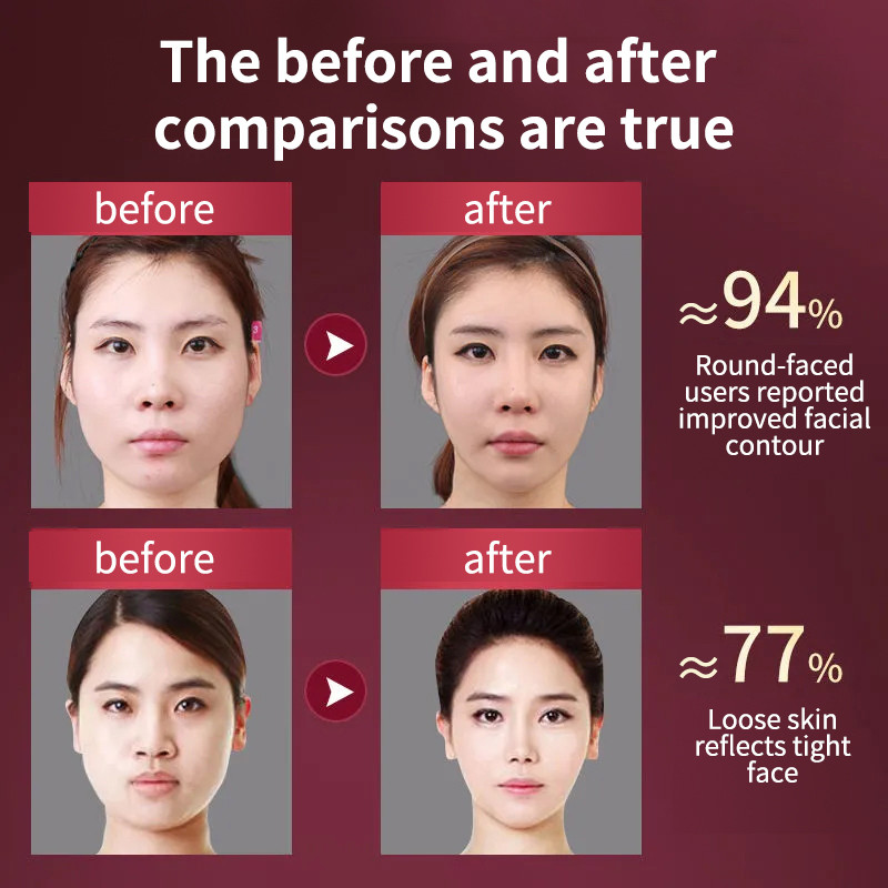 Dispozitiv de ridicare a feței Terapie cu LED-uri fotonice pentru slăbire facială Barbie dublă în formă de V Masaj cu vibrații pentru lifting facial pentru obraz