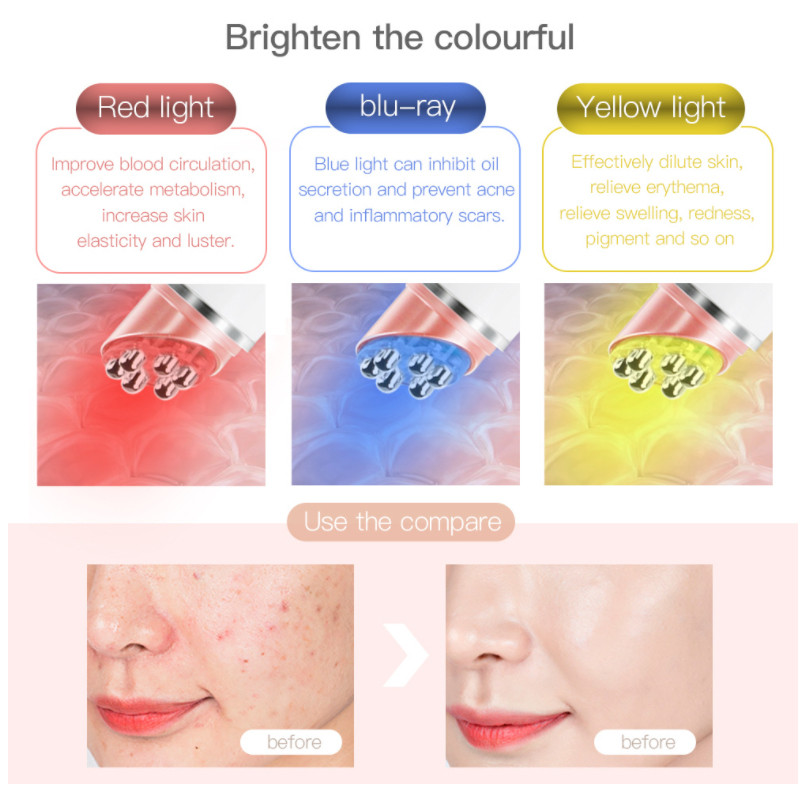 Elektrinis akių masažuoklis EMS karštas akių priežiūros aparatas nuo raukšlių mažinantis tamsius ratilus, paburkimą ir nuovargį mažinantis veido pakėlimo įtaisas