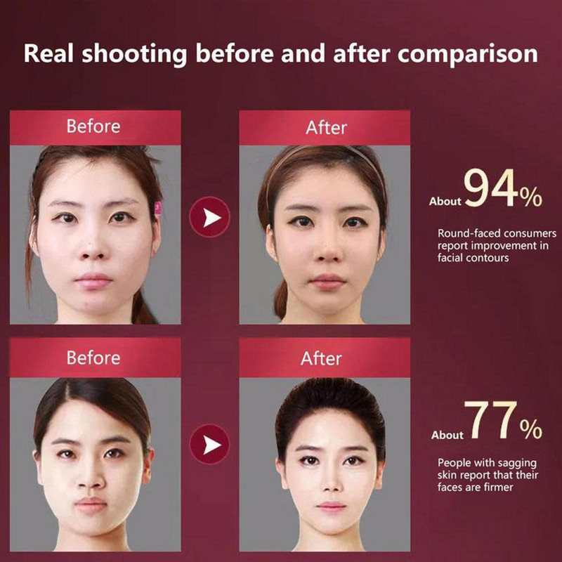 Uređaj za podizanje lica LED Photon Therapy Facial Slimming Lift Massager Podesiva 12 vibracija Brzina lica Obrazi u obliku slova V Z8K3