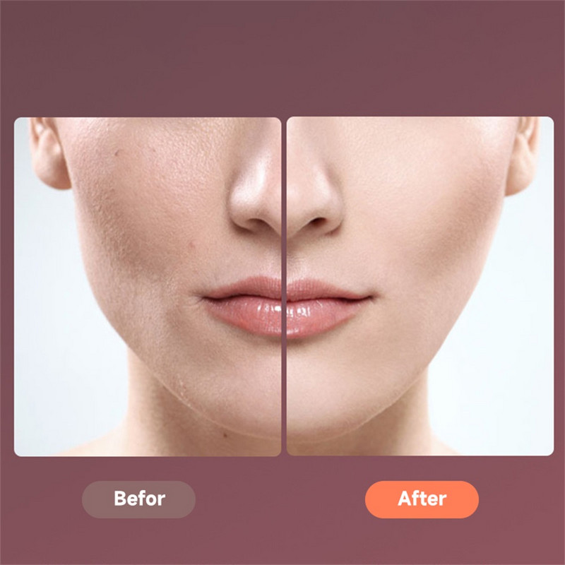 EMS Facial Lifting Device LED foton terápiás arc karcsúsító vibrációs masszírozó dupla álla V arcformázó arc emelő öv gép
