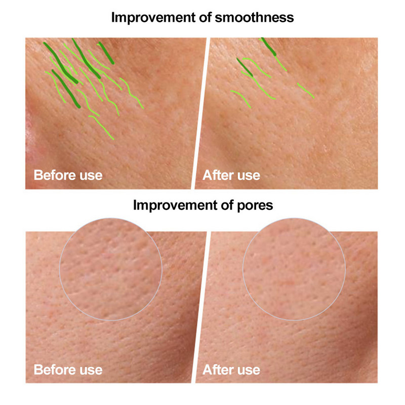 4 spalvų LED veido kaukė Silikoninė gelis infraraudonųjų spindulių fotonų terapijos odos atjauninimo priemonė nuo raukšlių šalinimo veido odos SPA kaukė