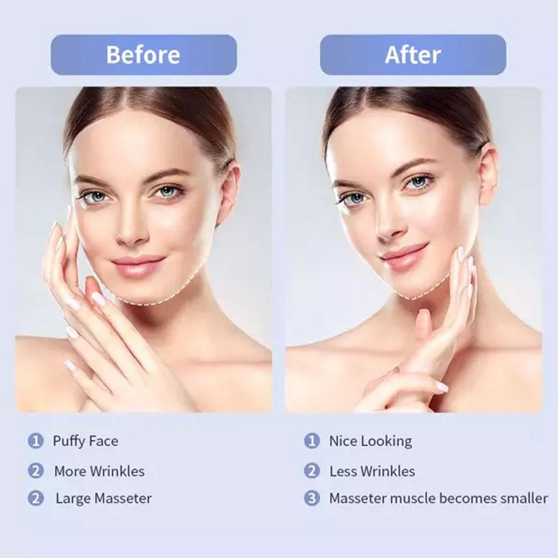 EMS Facial Lifting Device LED Photon Therapy Arc Karcsúsító Áll Vibrációs Állkapocs Cellulit Dupla eszköz Lift Vonal Öv Masszázs D7R8