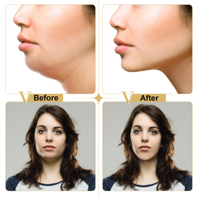 Arc emelő karcsúsító maszk V vonalas állfelhúzó tapasz 4D Reduce Double Chin Tape nyakfeszesítő alakformáló maszk US BR Do Dropshipping