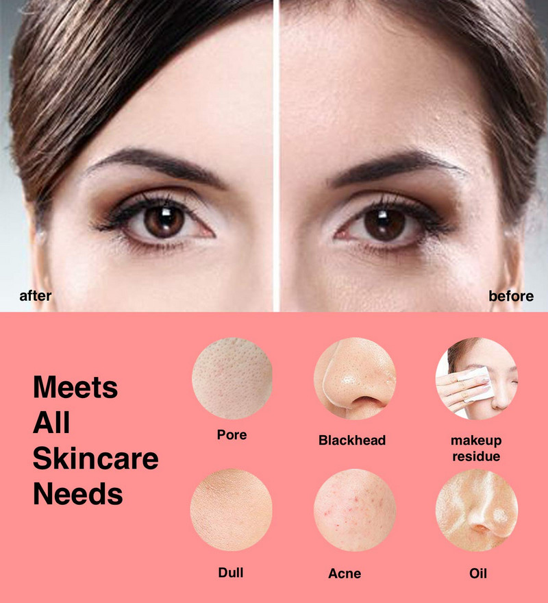 Sonic četka za čišćenje lica, vodootporna silikonska četka za lice za piling, uklanjanje mitesera Stroj za pranje kože Putovanje