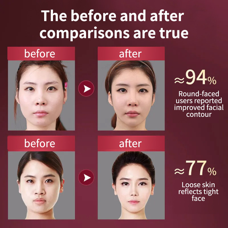 12 načina rada Uređaj za podizanje lica LED Photon Therapy Vibracijski masažer za mršavljenje lica Reduktor dvostruke brade V pojas za podizanje lica i obraza