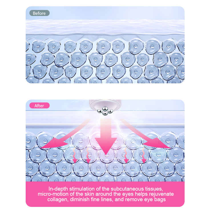 Eyes Massager EMS RF Beauty Device Bőrápolás Bőrfeszesítő ráncok Sötét karikák Távolítsa el a jobb szemkörnyékápoló krém felszívódását USB töltés