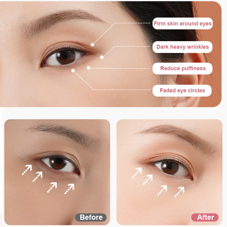 Eyes Massager EMS RF Beauty Device Bőrápolás Bőrfeszesítő ráncok Sötét karikák Távolítsa el a jobb szemkörnyékápoló krém felszívódását USB töltés