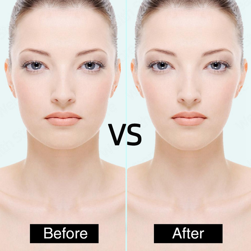 Еластична превръзка за лице V Line Tapes for Face Slimming Massager for Face Roller Lift Up Belt Facial Massage Skin Care Beauty Tools