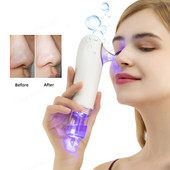 Curățător facial pentru îndepărtarea punctelor negre, cu bule mici, acnee, îndepărtarea cosurilor, instrument de îngrijire a pielii pentru spa, mașină de curățare a feței