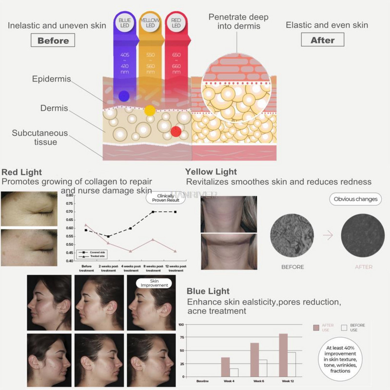 Led Masker Huidverjonging Gezichtsverzorging Gezicht Aanscherping Photon Lichttherapie Maszkoló Öregedésgátló Anti-Rimpel
