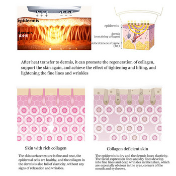 Six Polar RF Лифтинг за стягане на бръчки Премахване на тъмни торбички под очите Намаляване на брадичката Повдигане на врата против стареене Устройство за грижа за лицето