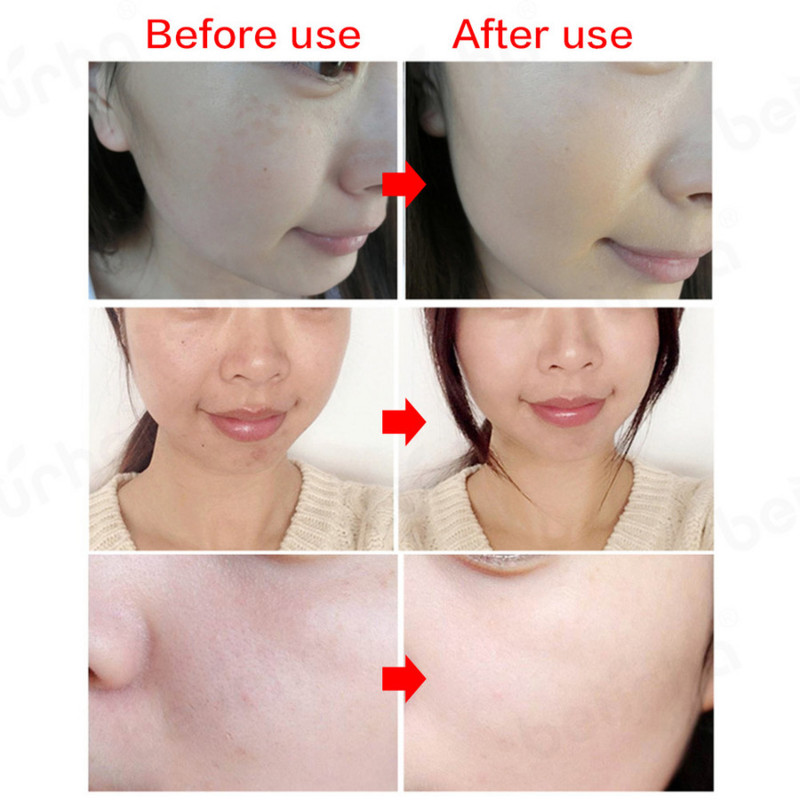 7 Colors Led Facial Mask Face Mask Machine Led Red Light Therapy Bőrfiatalító Led Anti Wrinkle Elektronikus Arcmaszk Hufu