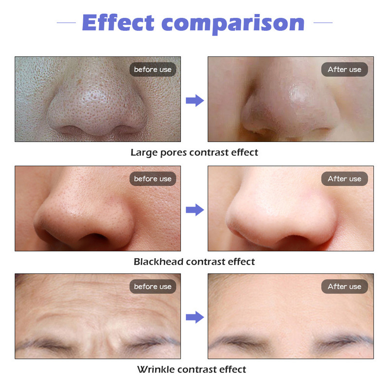 Μάσκα προσώπου LED Beauty Skin Rejuvenation Photon Light Facial Machine 7 Colors Mask Therapy Wrinkle Acne Tighten Skin Tool