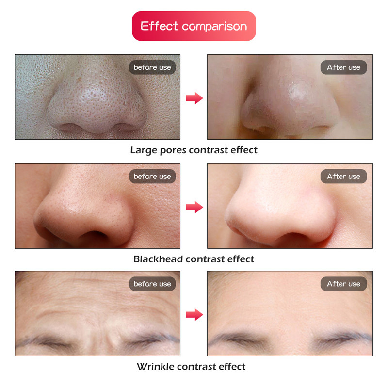 Μάσκα προσώπου 7 χρωμάτων Light LED με Αναζωογόνηση του δέρματος του λαιμού Μάσκα θεραπείας κατά της γήρανσης του δέρματος Hifu Face Skin Care Beauty Machine