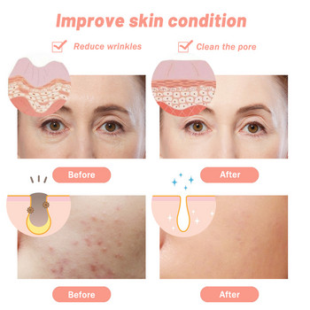 7 Χρώματα Electric Led Facial Mask Skin Rejuvenation Light Therapy Anti-aging Face Mask Rejuvenation Συσκευή Brighten Hifu Beauty
