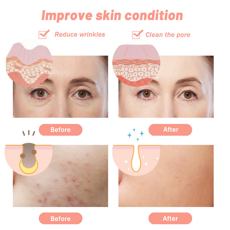 7 színű elektromos Led arcmaszk Bőrfiatalító fényterápia öregedésgátló arcmaszk fiatalító Brighten Hifu Beauty Device