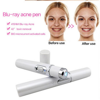KD-790 Blu-ray ακμής αφαίρεσης στυλό Facial Beauty Instrument Remove Dark Circles Eye Massage Stick Eye Beauty Instrument