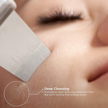 Επαναφορτιζόμενη μηχανή υπερήχων καθαρισμού προσώπου με υπερήχους Skin Scrubber Cleanser Vibration Removal Facial Pore Peeling