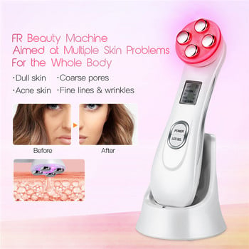 CkeyiN Ултразвуков скрубер за кожа Шпатула за лице Deap Cleaning Skin Peeling Face Cleaner RF EMS LED Beauty Device Mini Nano mister