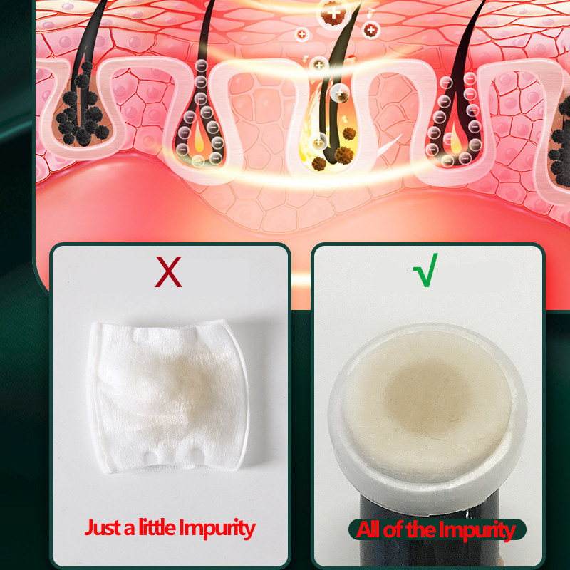 4+3 rinkinys ultragarsinis odos šveitiklis porų valiklis veido joninis gilus veido valymas garsinio šveitimo įrankiai EMS veido radiomezoterapija