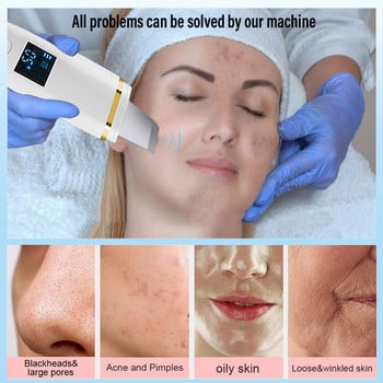 Ultrasonic Skin Scrubber Facial Peeling Remover Blackhead Deep Face Cleaning Pore Spatula Ultrasonic Face Cleaning Skin scrubber