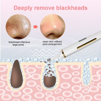 Ultrasonic Skin Scrubber Facial Peeling Remover Blackhead Deep Face Cleaning Pore Spatula Ultrasonic Face Cleaning Skin scrubber