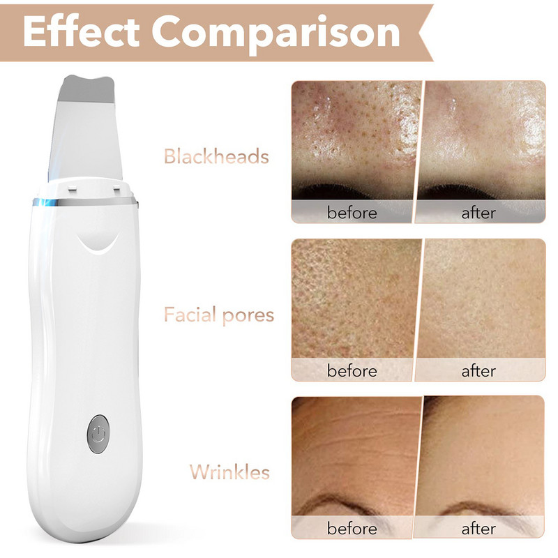 Ultrahangos bőrradír készlet vibrációs arc spatula mitesszer eltávolító EMS LED arcmasszírozó kavitációs peeling arc lifting