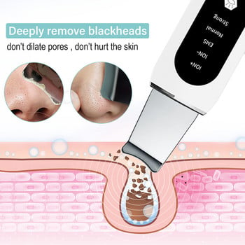 Ultrasonic Skin Scrubber Peeling Remover Blackhead Deep Face Cleaning Ultrasonic Ion Ance Pore Cleaner Facial Shovel Cleanser