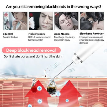 CkeyiN Ултразвуков скрубер за кожа Acne Blackhead Remover EMS Лифтинг на лицето Свиване на порите Дълбоко почистване Скрепер Шпатула за пилинг на мъртва кожа