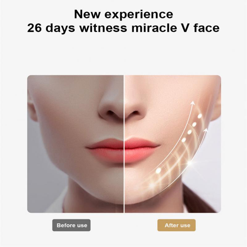 Ultrahangos bőrradír peeling lapát Ion akne mitesszer eltávolító mélytisztító gép arc lifting arcmasszírozó