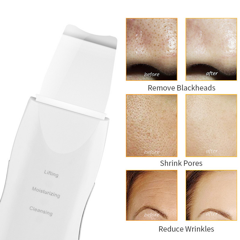 Skin scrubber vibrációs masszázs mély arctisztító spatula mitesszer eltávolító peeling lapát arc pórustisztító arc lifting eszköz