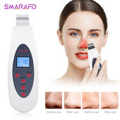 Ultrahangos bőrradír mély arctisztító gép eltávolítása Arcmasszírozó Ultrahangos peeling Clean Tone Lift LW006