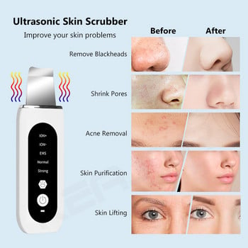 Ultrasonic Skin Scrubber Facial Shovel Deep Cleaning Remover Blackhead Face Cleanser Pore Dead Peeling Cavitation Ion EMS Lift