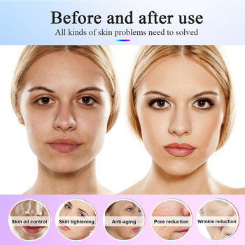 7 Χρώματα Led Facial Mask Anti Acne Μηχανή θεραπείας με κόκκινο φως Αφαίρεση ρυτίδων Skin Rejuvenating Tightening Facial Care Devices