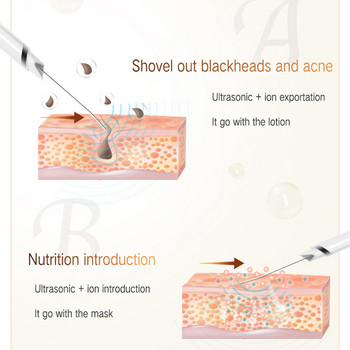 HSKOU Ултразвуков скрубер за кожа Машина за дълбоко почистване на лице Пилинг лопата Пречистване на порите на лицето Машина за повдигане на кожата на лицето