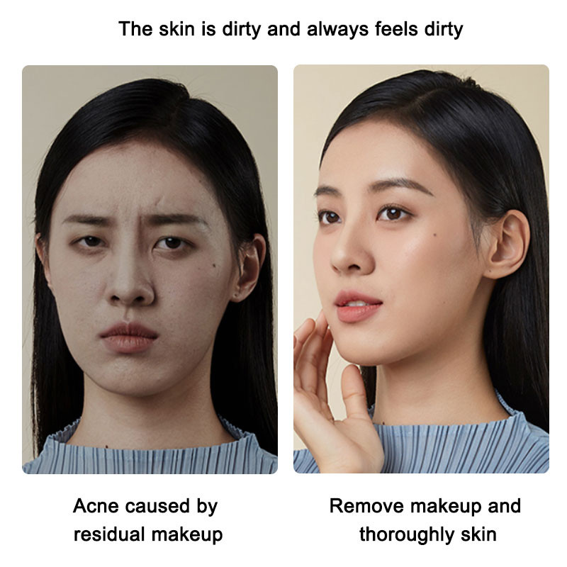 Ultrahangos bőrradír tisztító Arctisztító akne eltávolítás Galvános arcfürdő ultrahangos peeling Clean Tone Lift LW006