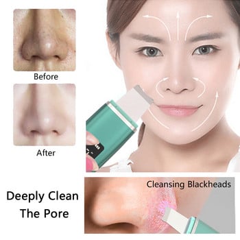 Ultrasonic Skin Scrubber Pore Cleaner Remover Face Lift Devices Deep Cleaning Deep Cleaning Απολέπιση Peeling Μηχανή περιποίησης προσώπου