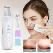 Scrubber cu ultrasunete pentru piele Mașină de curățare în profunzime a feței Lopată de peeling Dispozitiv de curățare a porilor faciali Scrubber pentru piele de față Lift Instrument de frumusețe