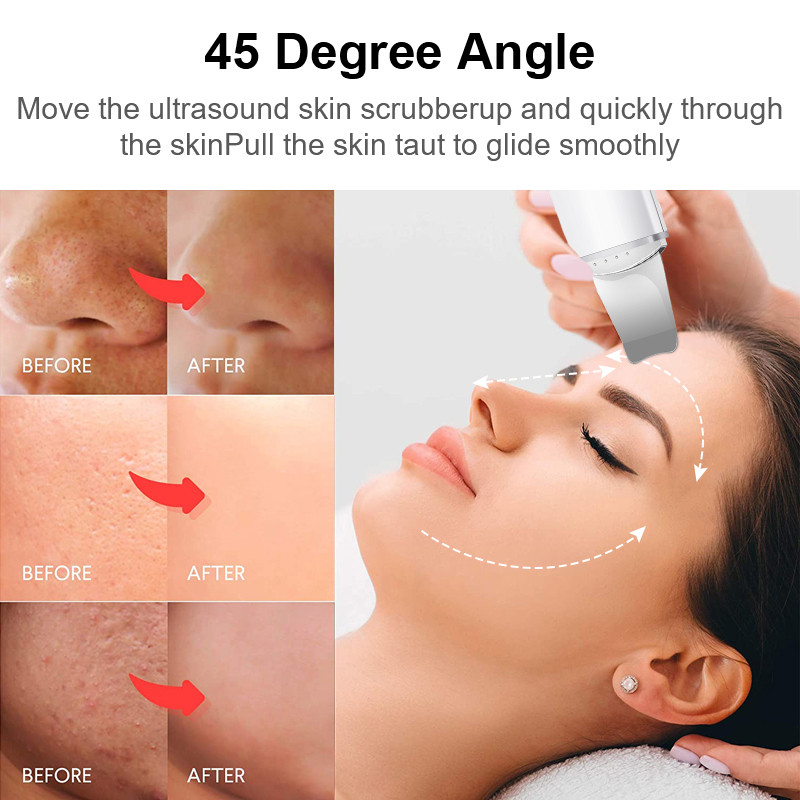 Ultrahangos bőrradír peeling arc mitesszer eltávolító arc lifting hámlasztó tisztító mély arctisztító arcmasszírozó