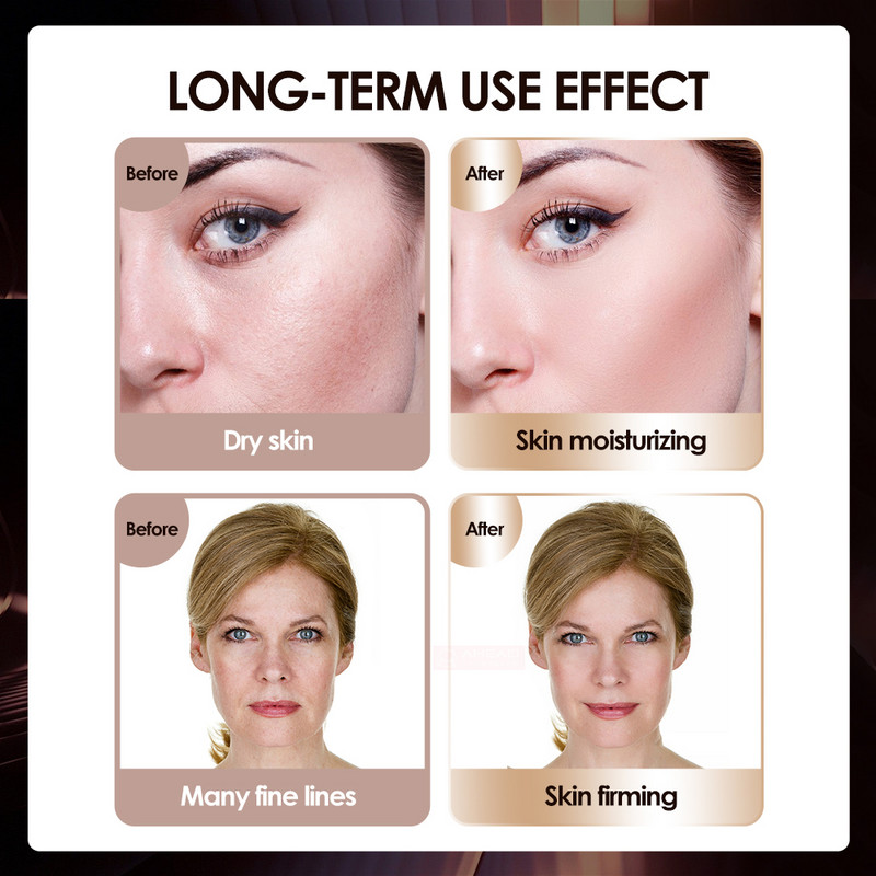 4 in 1 Mini Hifu Machine Ultragarsinis RF EMS PULSE veido grožio prietaisas kaklą pakeliantis odą stangrinantis veido masažuoklis nuo raukšlių